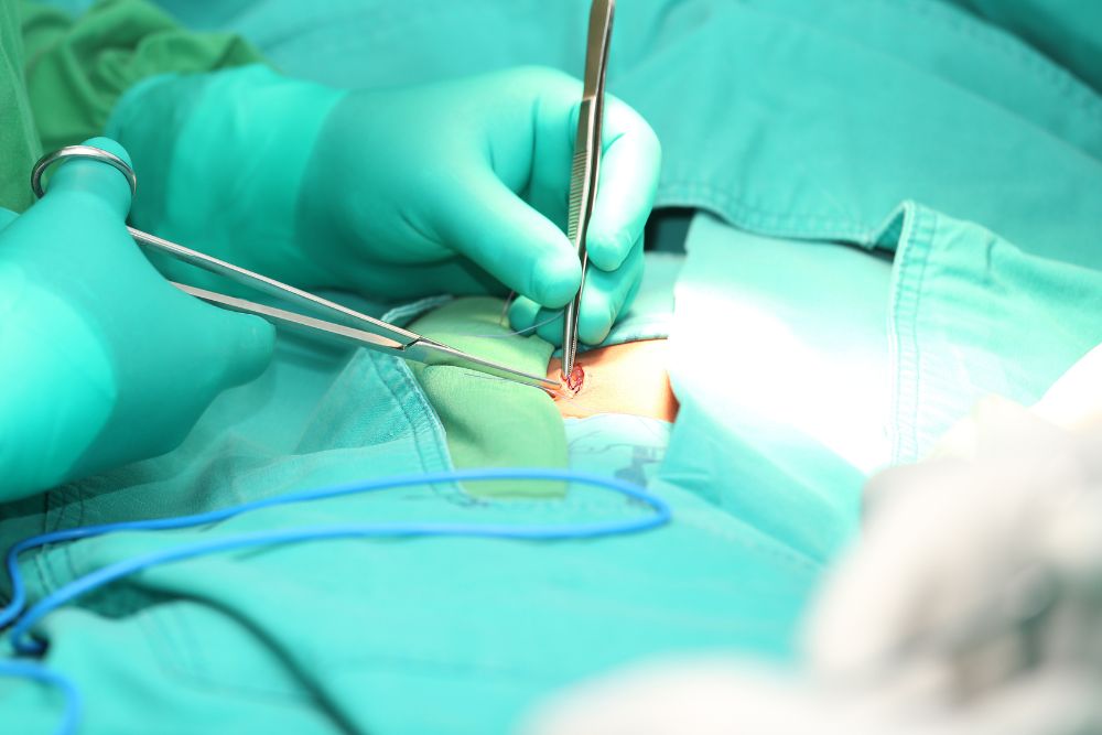 Hernia Surgeries