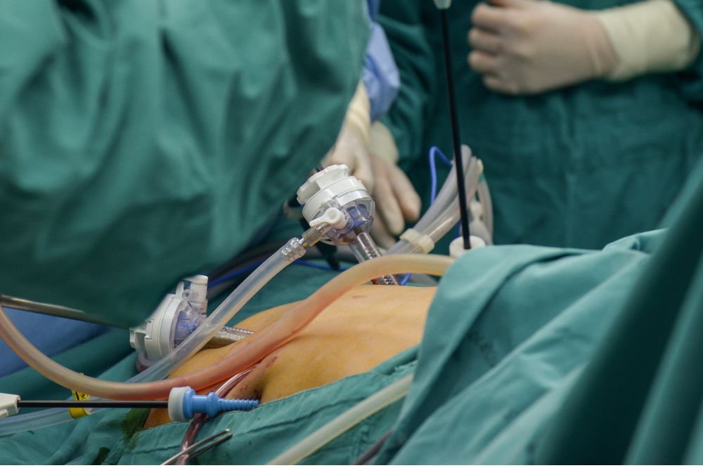 Liver Surgeries