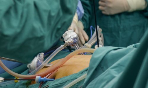 Liver Surgeries